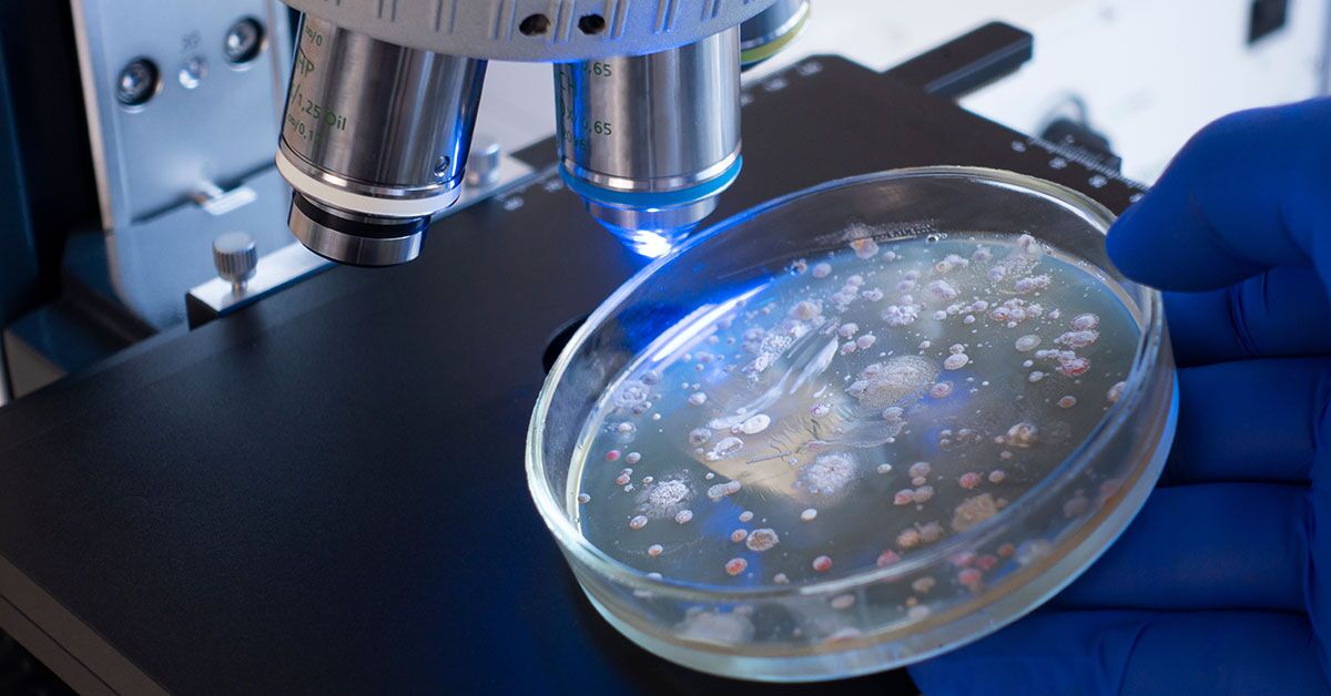 Microbes: The Tiny Survivors With Big Secrets! 1 Blog Thumbnail June 2