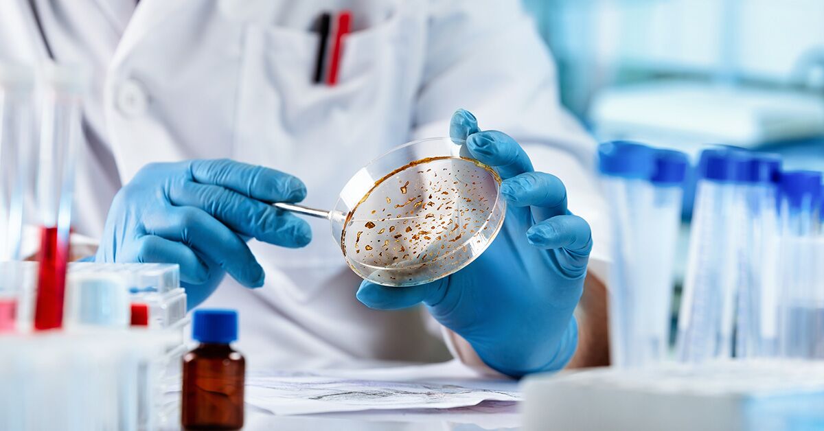 Microbial Appetites: From Glucose Lovers to Pollution Eaters 1 A scientist in blue gloves examines a petri dish with microbial growth, symbolizing research into microbes for glucose consumption and pollution eating.