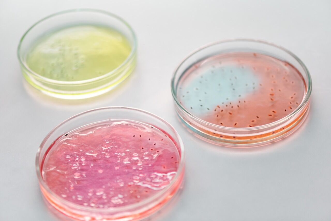 Understanding the Biological Process in Secondary Wastewater Treatment 1 Three petri dishes containing different colored media with visible microbial growth, representing cultures used to improve aerobic wastewater treatment efficiency.