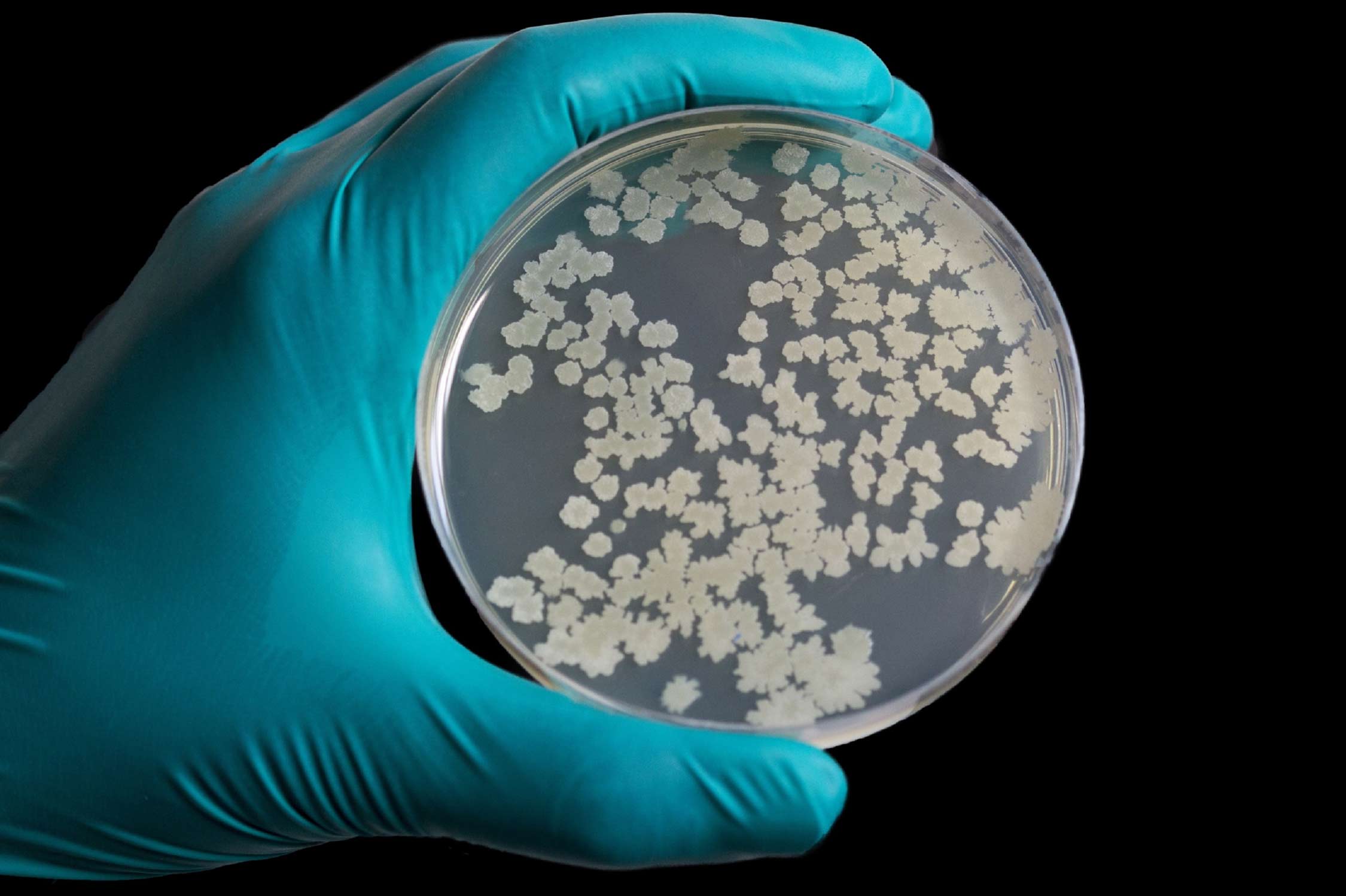 How Microbial Replenishment Is an Effective Strategy For Fecal Sludge Management 1 A gloved hand holds a petri dish filled with numerous white microbial colonies, signifying active growth and replenishment.